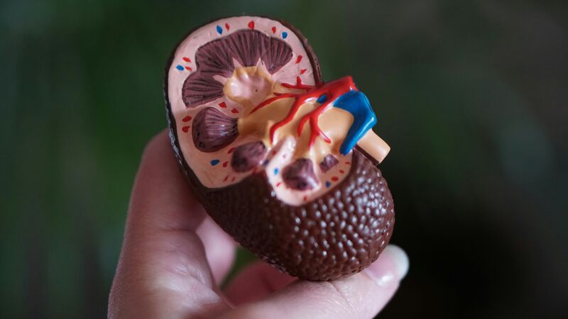 Doença Renal Crônica